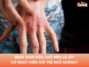 Bệnh giun đũa chó mèo là gì? Có nguy hiểm với trẻ nhỏ không?