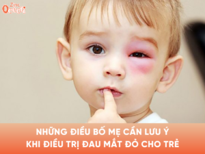 Những điều bố mẹ cần lưu ý khi điều trị đau mắt đỏ cho trẻ