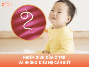 Nhiễm giun đũa ở trẻ và những điều mẹ cần biết!