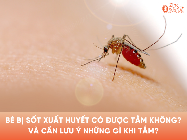 Bé bị sốt xuất huyết có được tắm không và cần lưu ý những gì khi tắm?